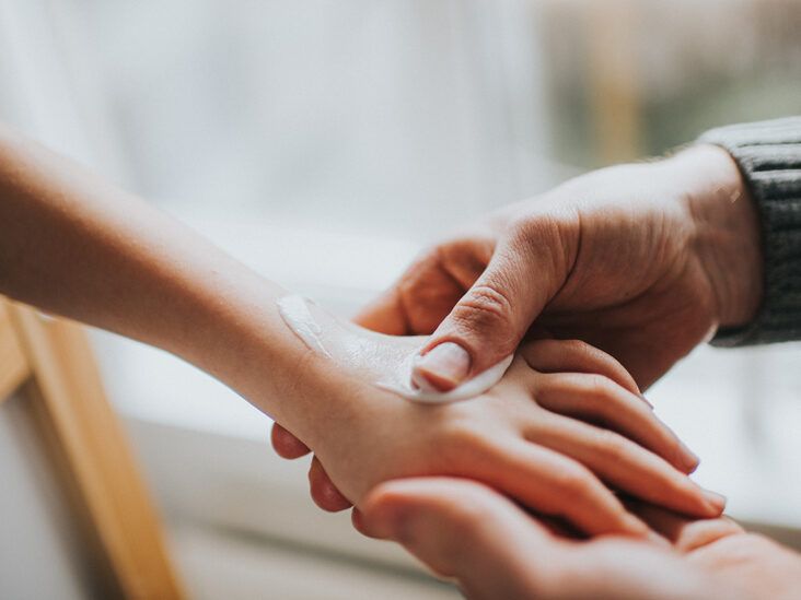 5 Ways to Treat Eczema Without Topical Steroids