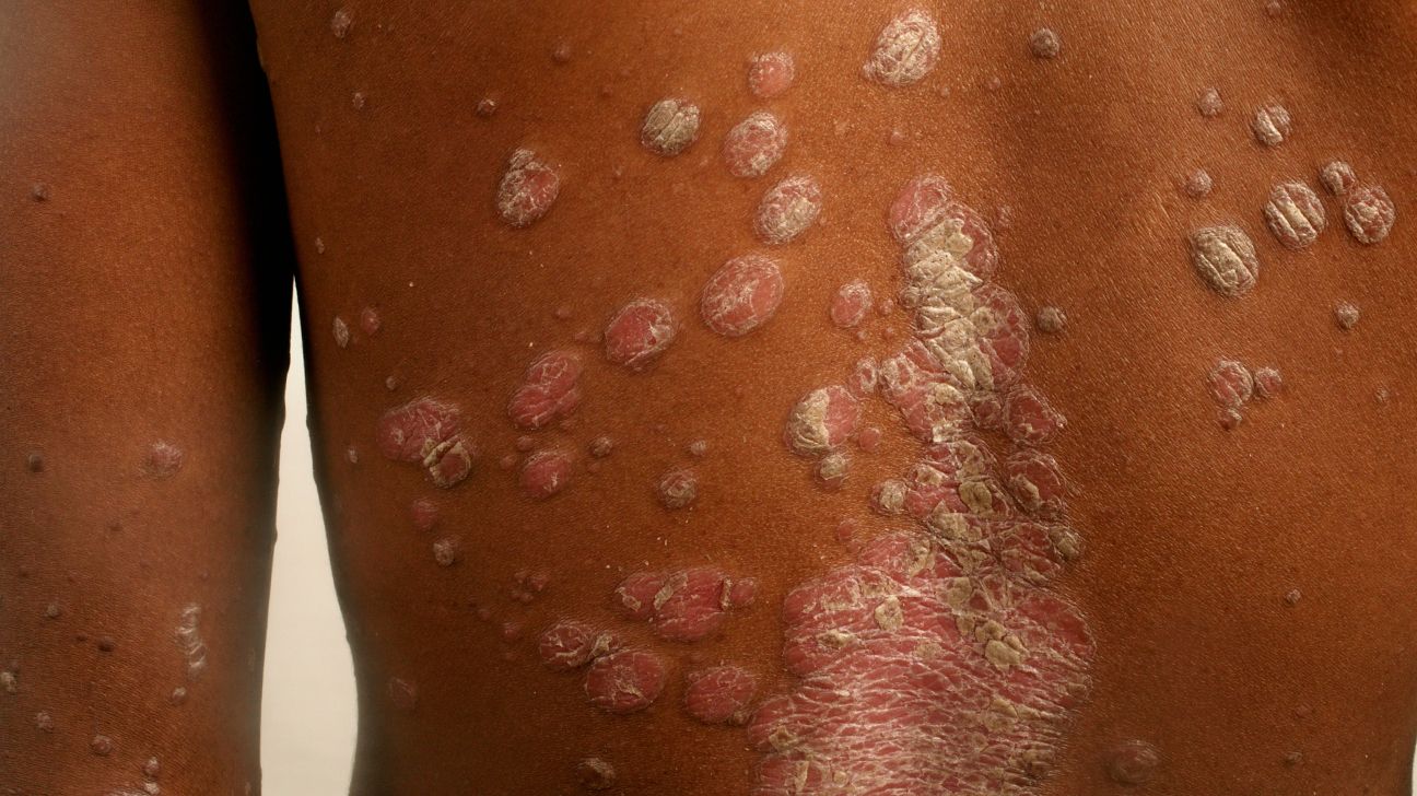 dangerous skin diseases