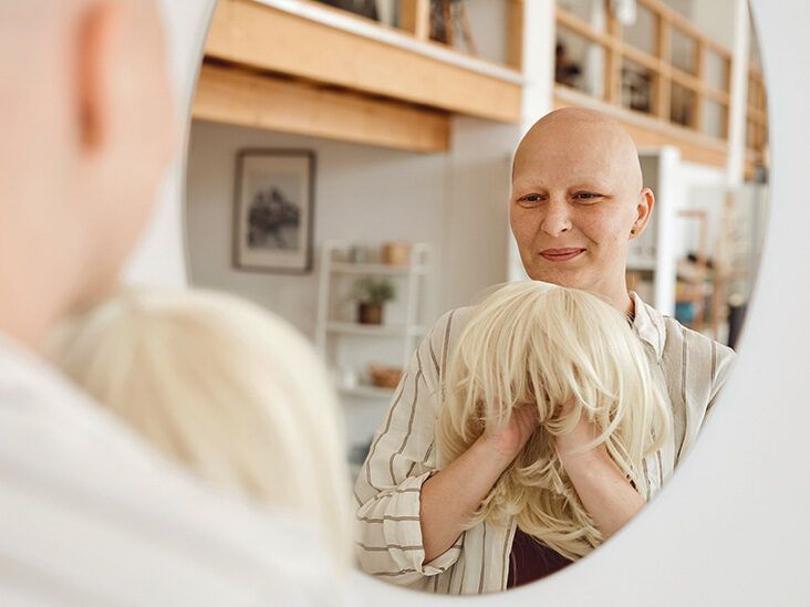 Beautiful Child Cancer Hair Loss Due Stock Photo 159655766  Shutterstock