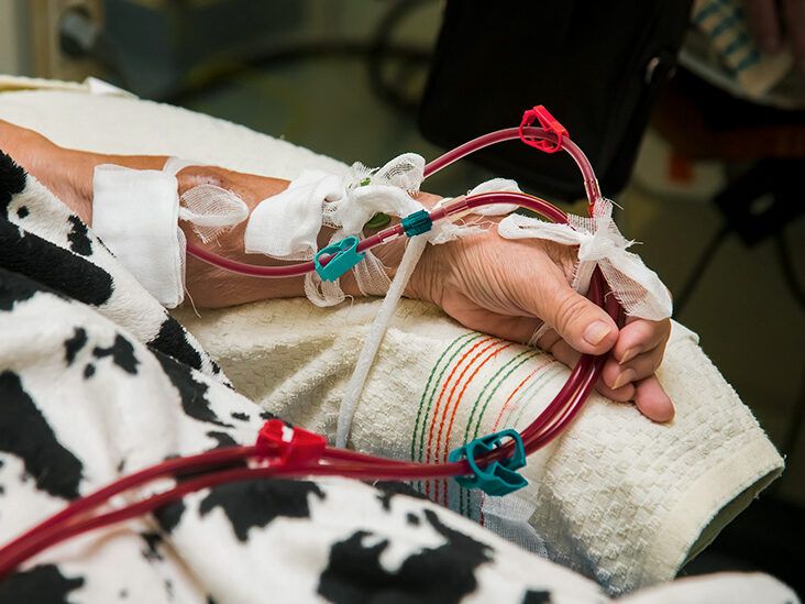 A Guide to Hemodialysis for Advanced Chronic Kidney Disease