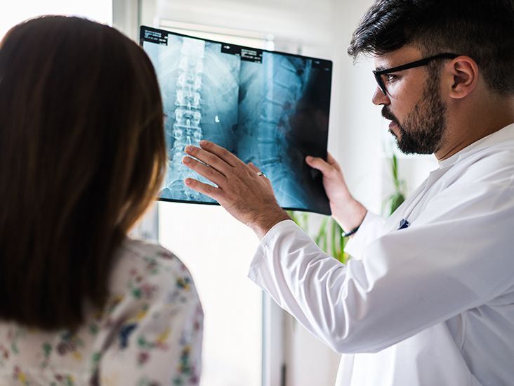 Understanding NonRadiographic Ankylosing Spondylitis (AS)