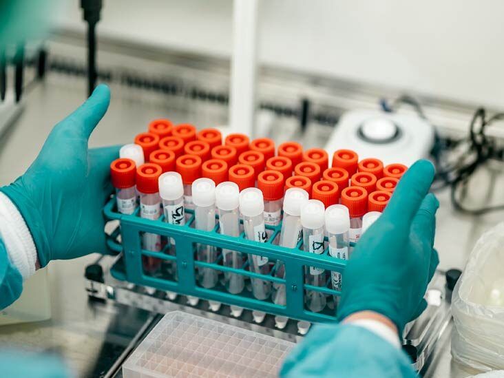 Can Gene Therapy Cure Type 1 Diabetes or Normalize Blood Sugars?