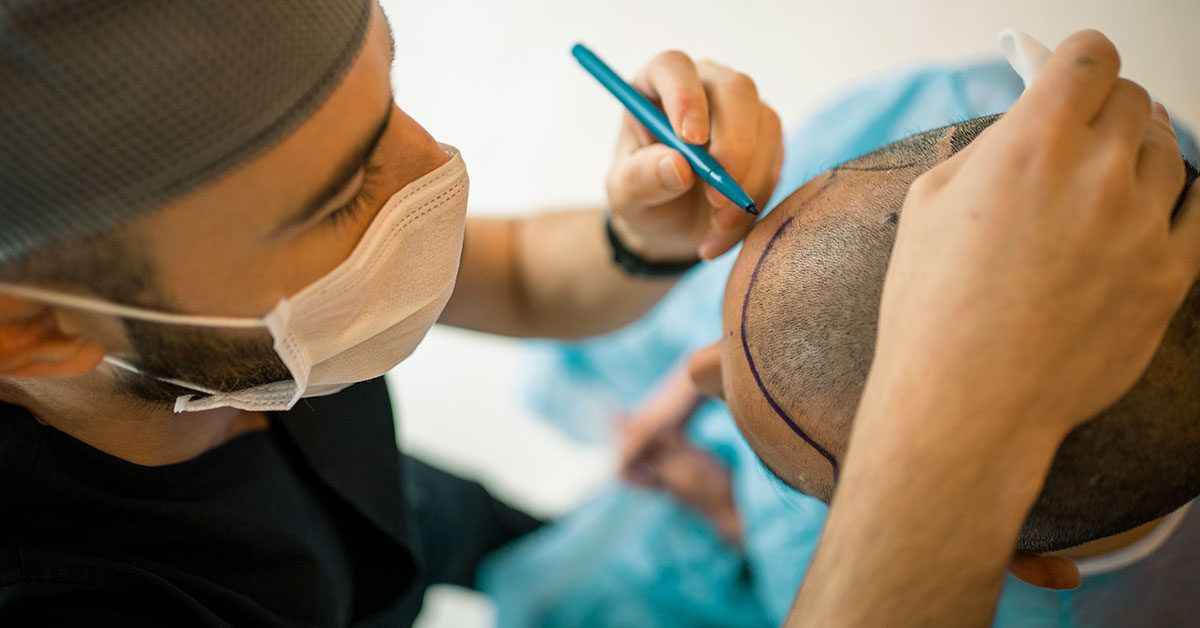 How To Ensure Proper Hair Care After Hair Transplant Surgery | by Marmm Hair  | Medium