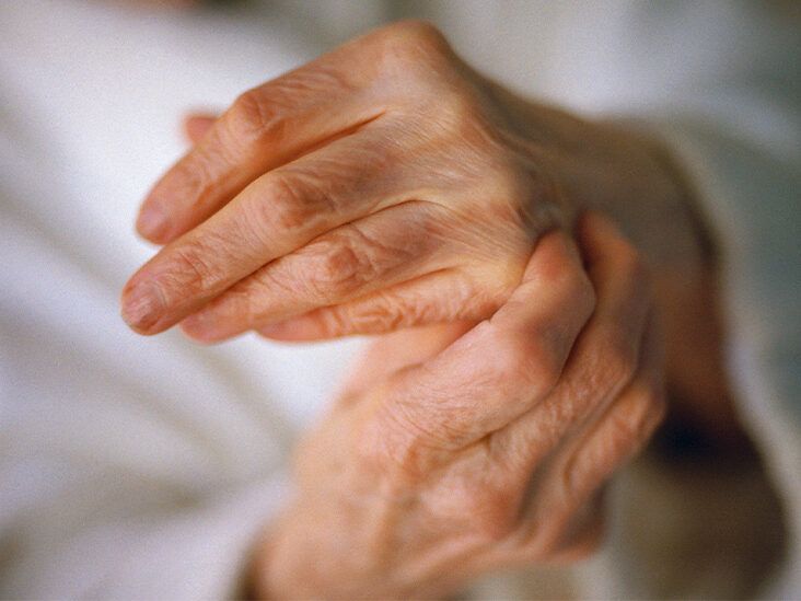 Arthritis vs. Arthralgia: What's the Difference?