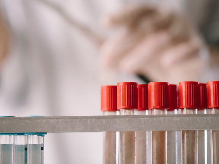 Understanding Lymphoproliferative Disorders: Types, Treatment, and More