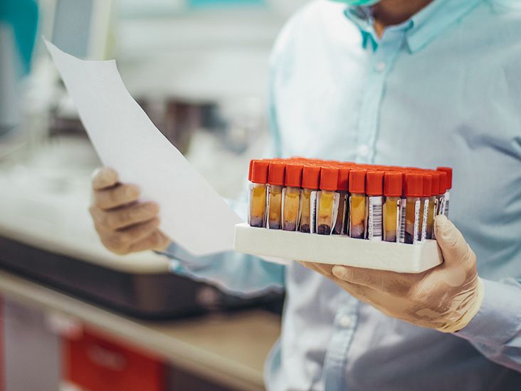 What To Do About Fluctuating Liver Enzyme Levels