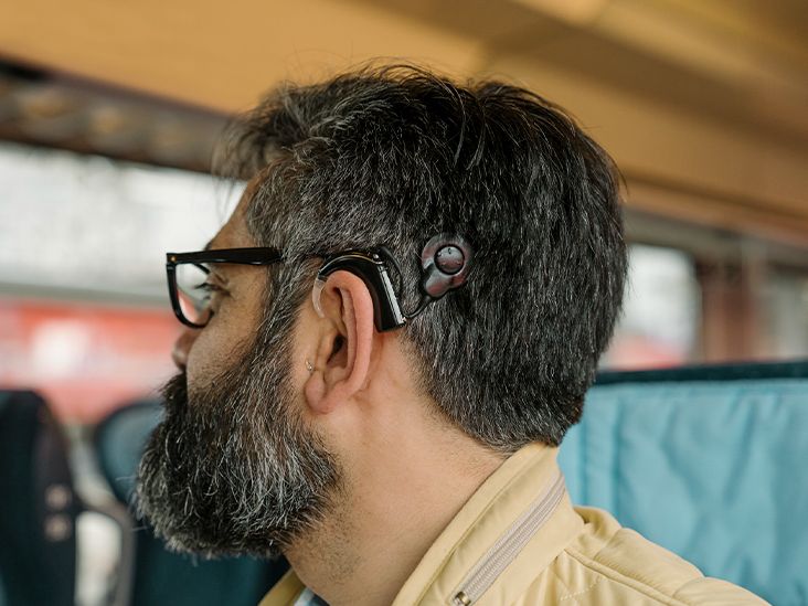 Cochlear Americas CODING AND REIMBURSEMENT | Specialty Series: