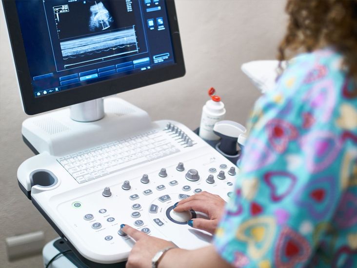 Ultrasound for Ectopic Pregnancy: What to Expect