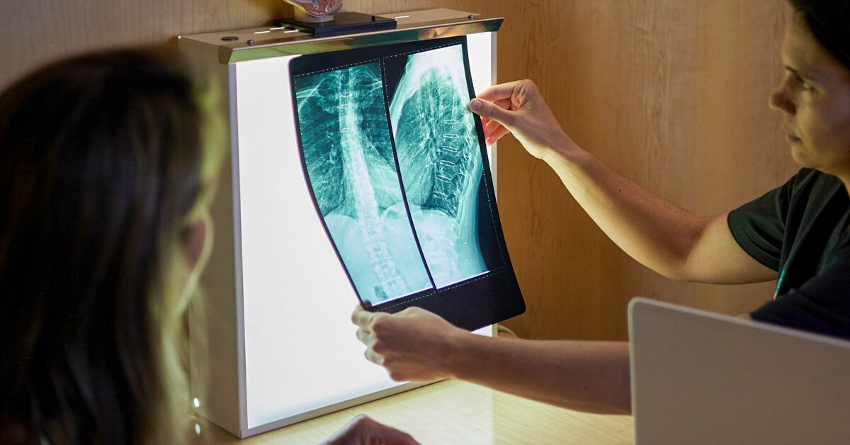 Schmorl’s Nodes: Causes, Diagnosis, and Treatment