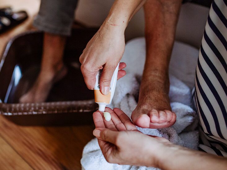 Your Treatment Options for Nail Psoriasis