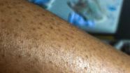 Black Dots On Arm Black Dots On Arm