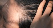 Do Lice Like Clean Hair Busting The Myth