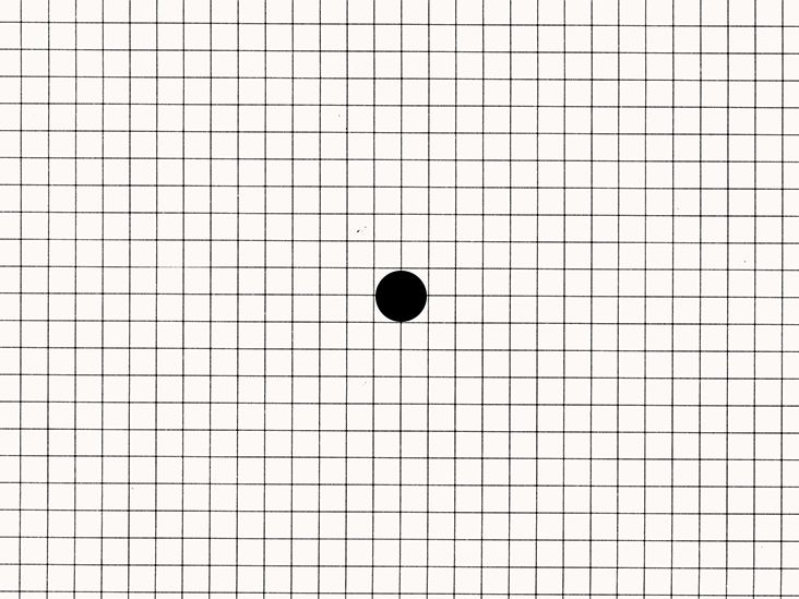 Amsler Grid - Smart Optometry