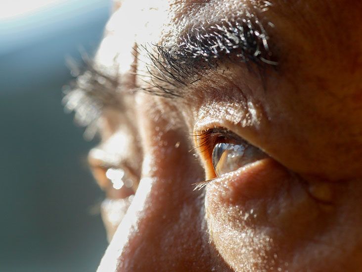 At What Age Does Macular Degeneration Usually Start?