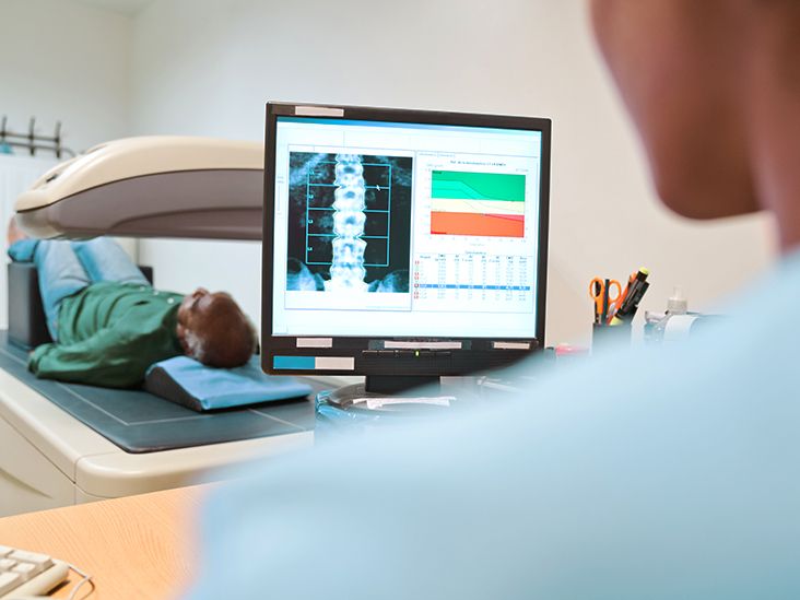 Bone Scan for Osteoporosis Purpose, Procedure, Results, Cost