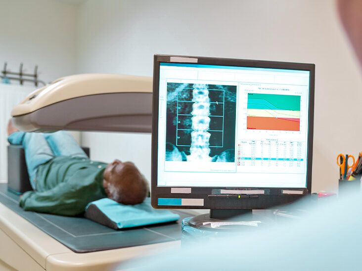 Understanding Bone Density Scan Results If You're Younger