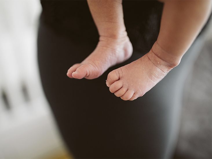 Syphilis in Newborns Increasing as Rates for STIs Fall, CDC Data Show