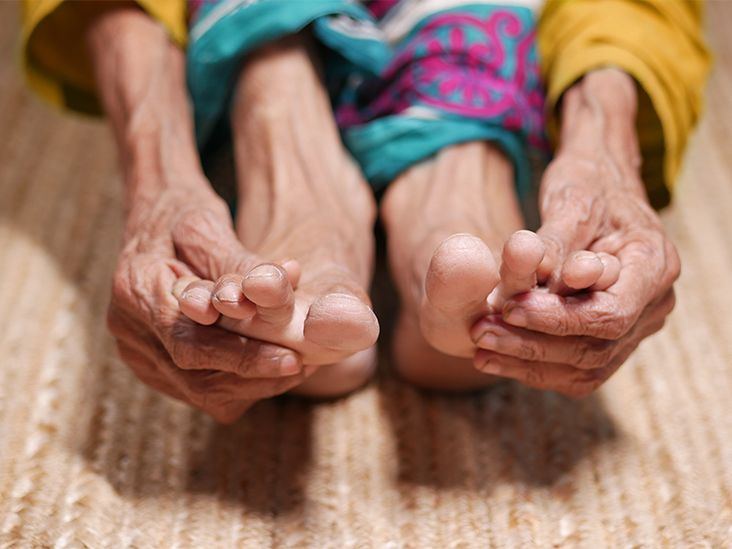 Foot Joint Pain Causes, Symptoms, and Management