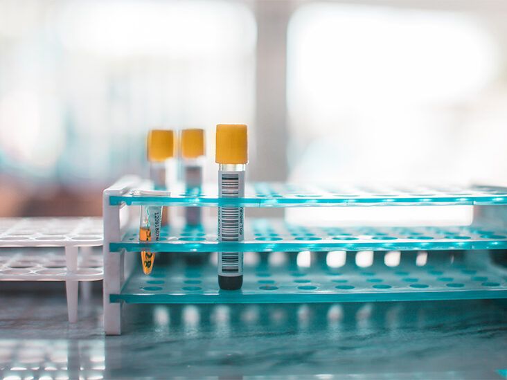 Genetic Testing for Hypertrophic Cardiomyopathy: An Expert Responds