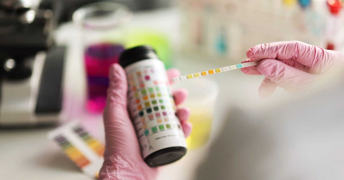 Normal (and Abnormal) Urine Test Results and What They Indicate