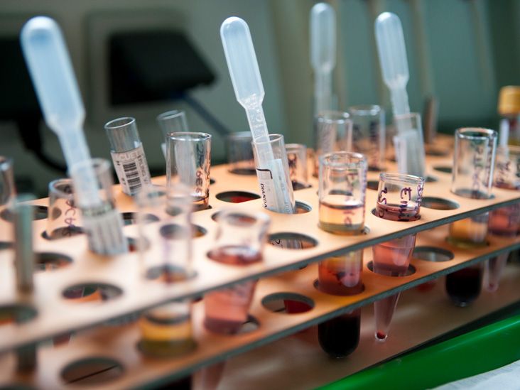 Stem Cells For Ulcerative Colitis How Close Are We To A Cure