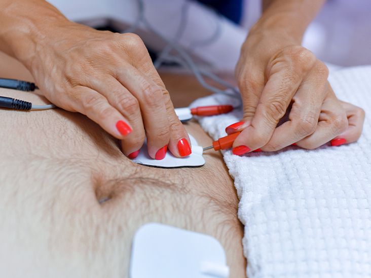 Setting up the TENS device for median nerve stimulation