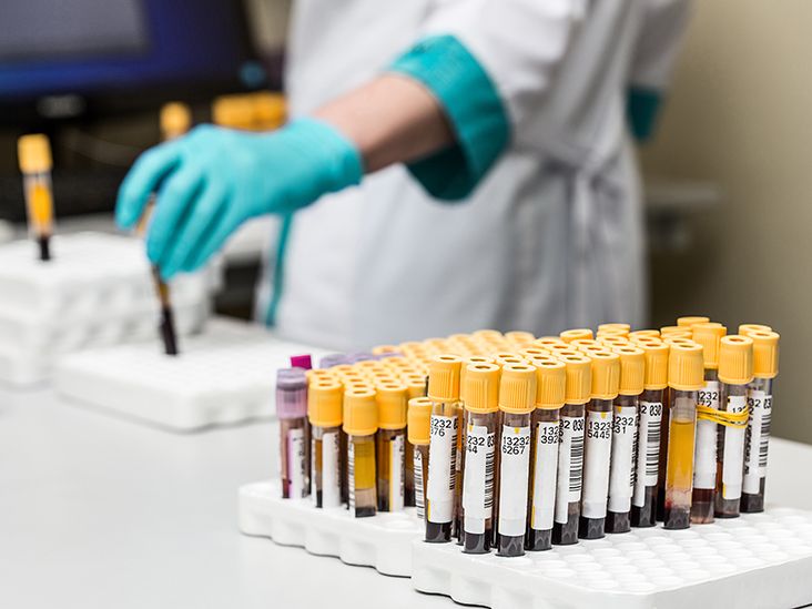 Esophageal Cancer Blood Tests and Other Diagnostic Tests