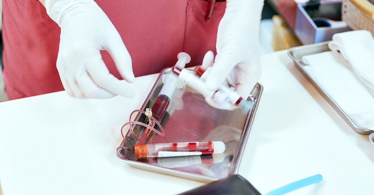 Seronegative Lupus: Causes, Diagnosis, and Treatment