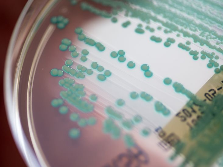 How Common Is MRSA?