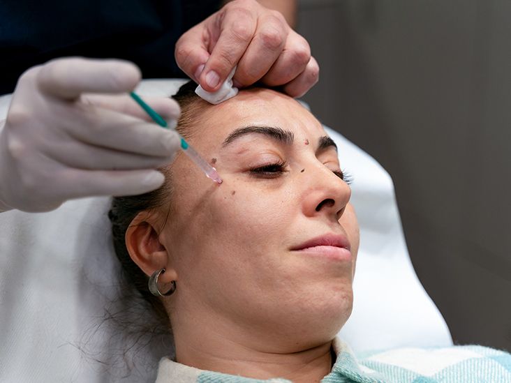 Can Botox Cause Dry Eyes? It’s Complicated