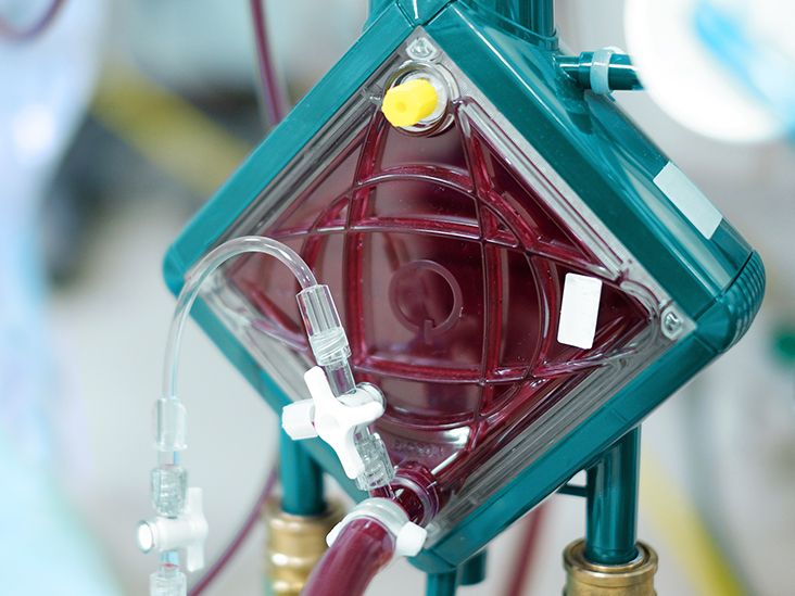 Extracorporeal Membrane Oxygenation Ecmo 