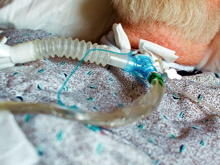 Obturator for Tracheostomy: How It's Used During Placement