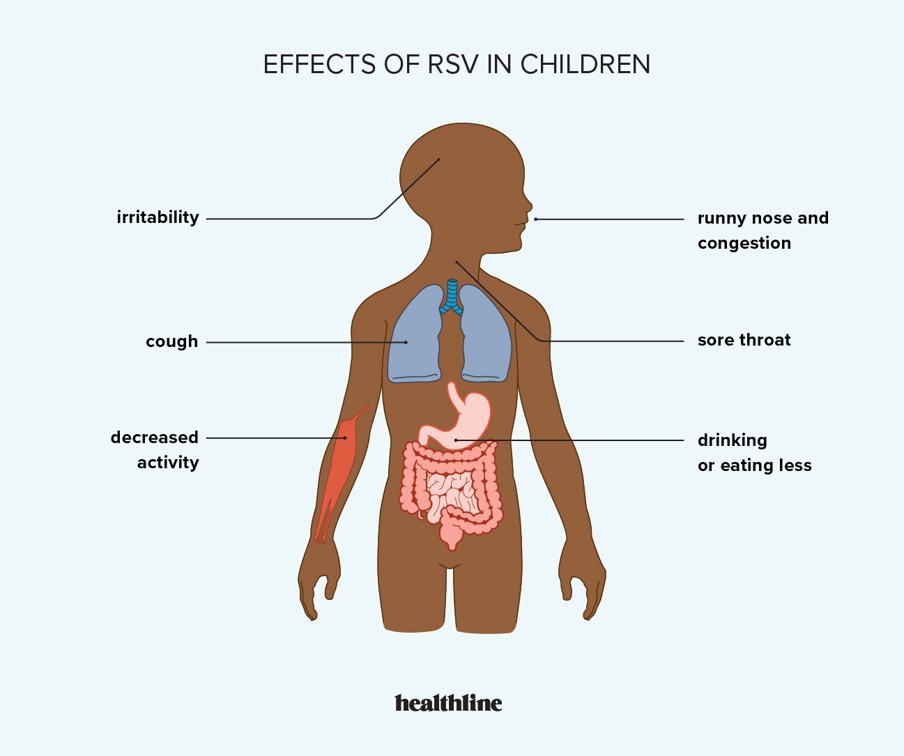 symptoms of RSV in children