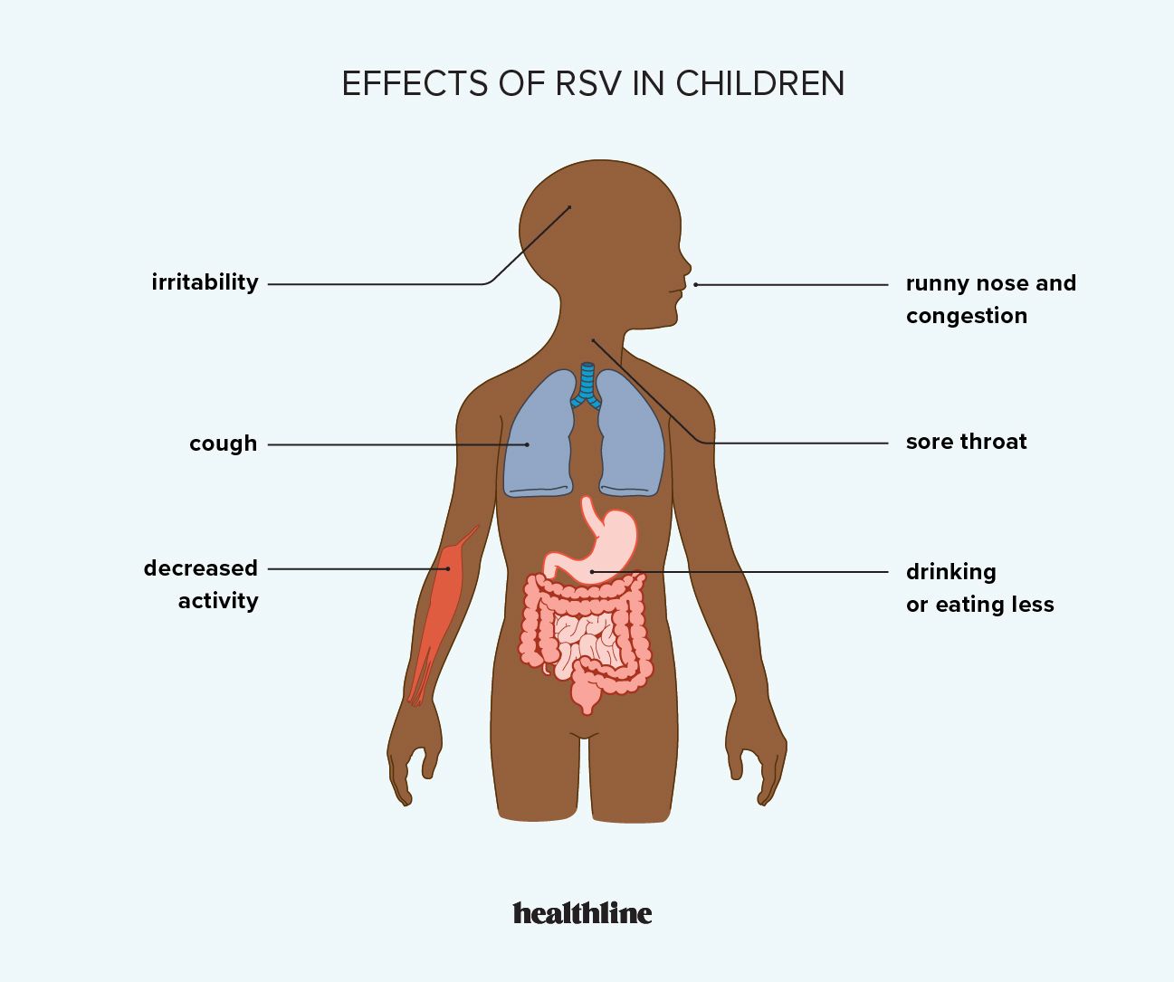 أعراض RSV عند الأطفال