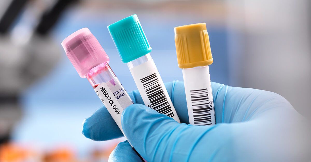 Understanding Your Blood Test for Cystic Fibrosis