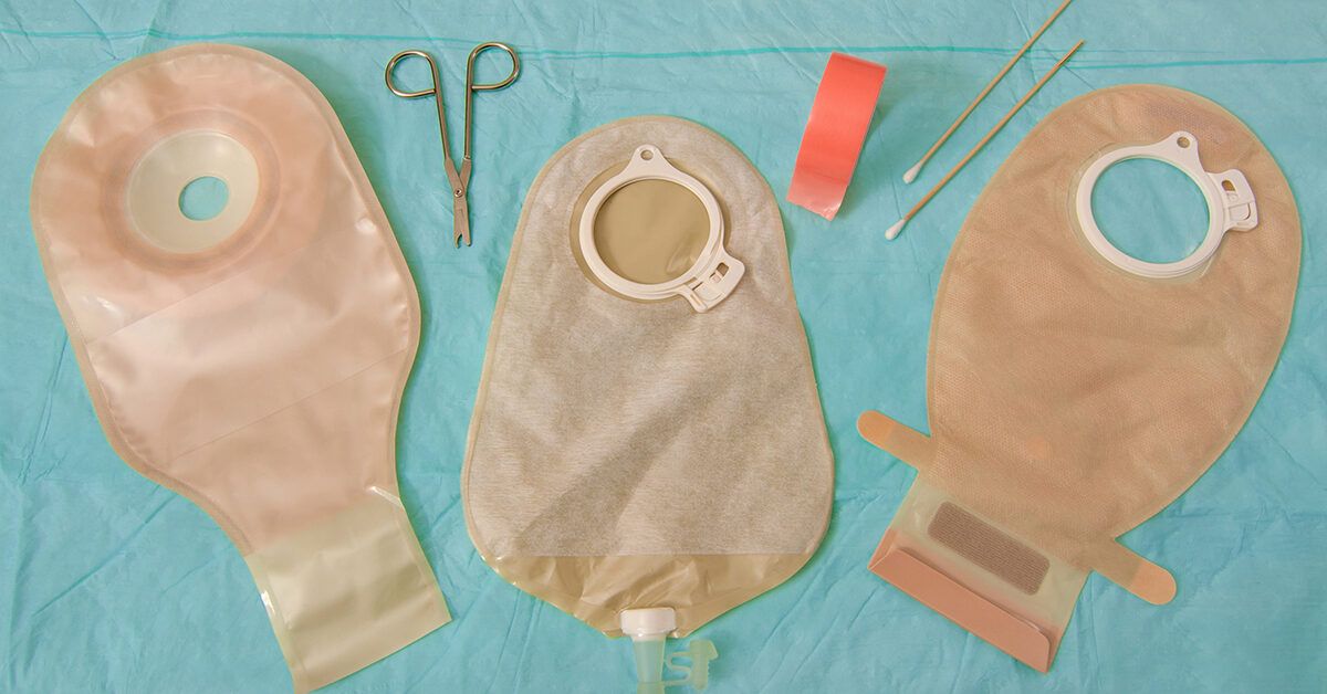 Change a Colostomy Bag Steps and Other Information To Help You