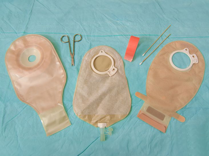 Change a Colostomy Bag: Steps and Other Information To Help You