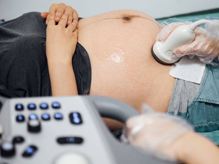 A pregnant person undergoes an ultrasound.