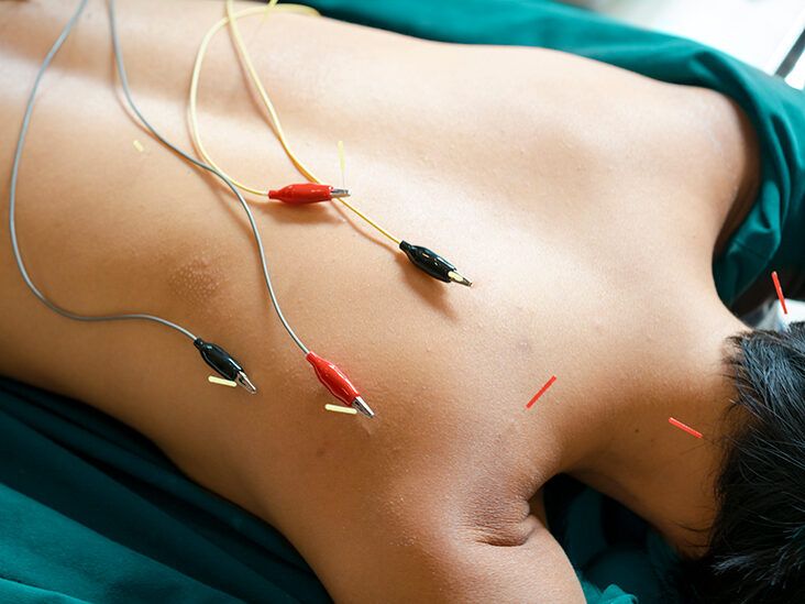All The Benefits Of E-Stim, The Must-Know Recovery Tool