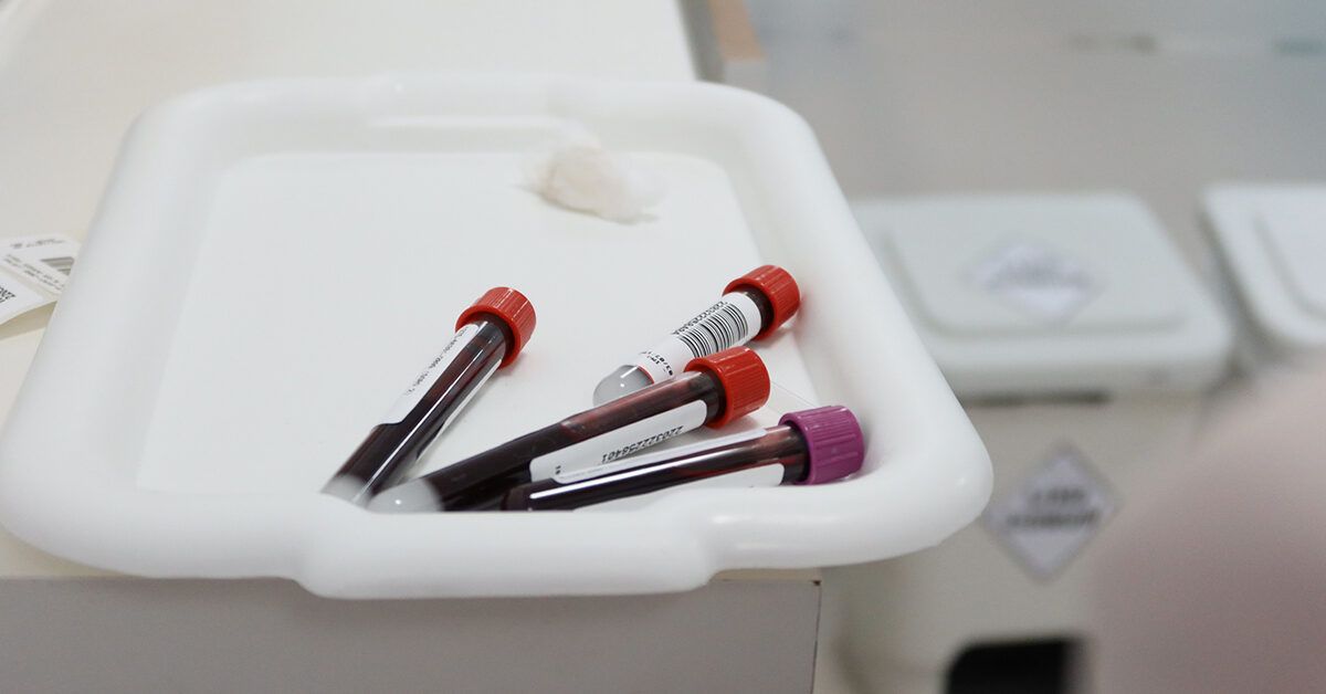 Blood Test: Highly sensitive blood test for cancer detection