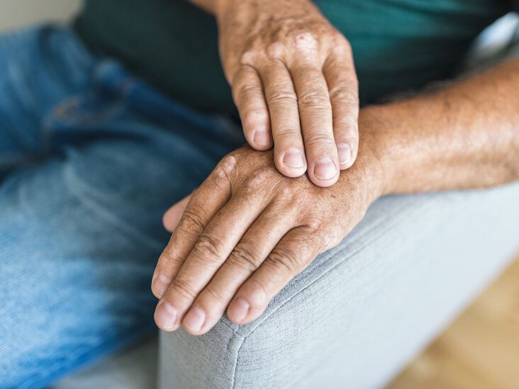15 Things to Know About Psoriatic Arthritis