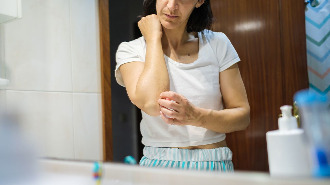 person with psoriasis scratching their elbow