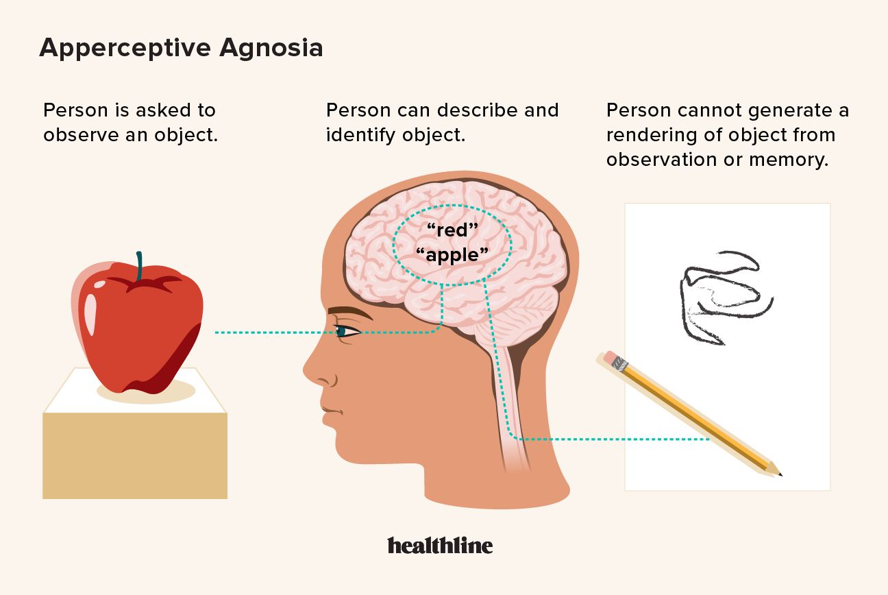 How people perceive and recall images with apperceptive agnosia
