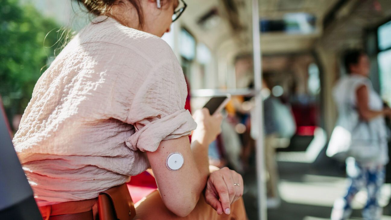 Apple Watch may track blood sugar levels, other health features