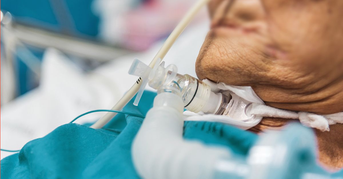 Tracheostomy Complications Short and Long Term