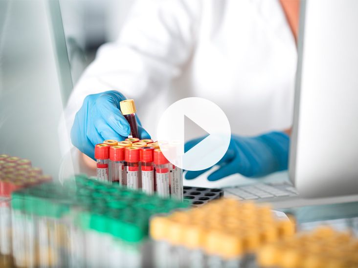 High Monocyte Count Potential Causes and Symptoms