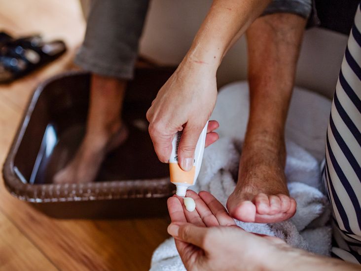 Fungal Nails - Podiatrist in Monticello, NY | Family Footcare Group, LLP