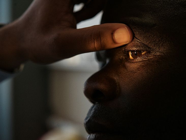 What Are the Most Common Types of Eye Cancer?