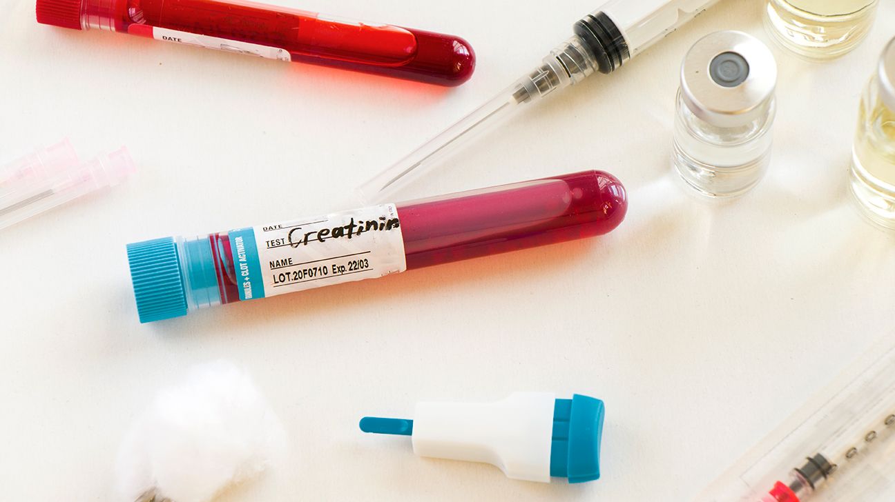 creatinin blood test