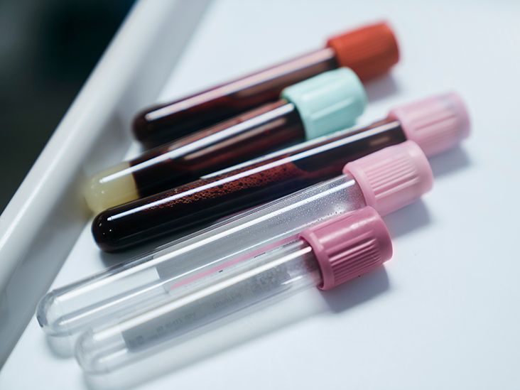Hemochromatosis Blood Tests and Other Diagnostic Testing
